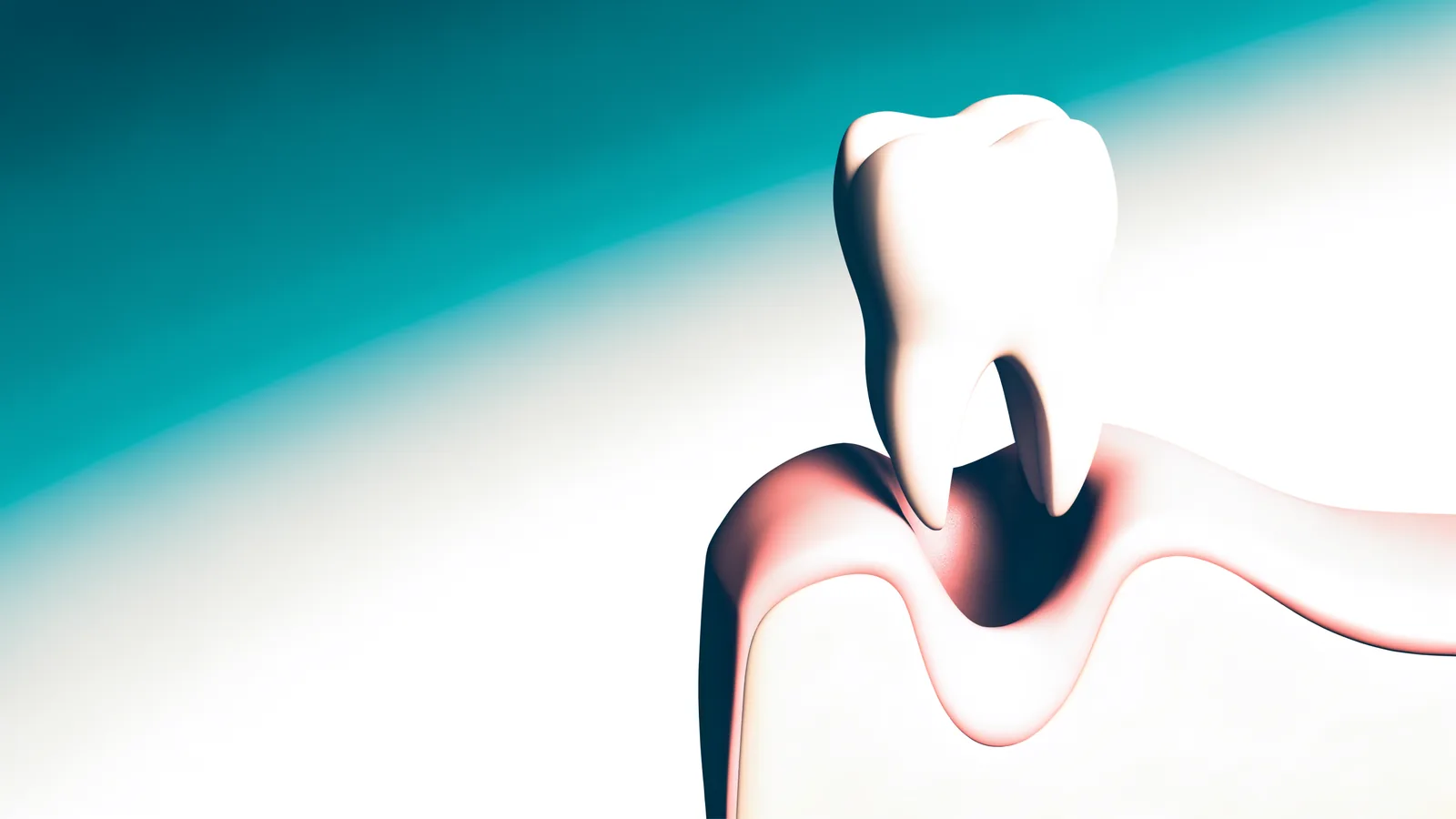 Ilustración 3D estilizada de un molar saliendo de la encía y dejando un alvéolo de extracción limpio