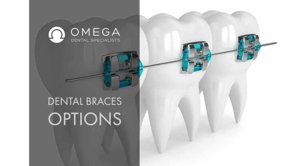 What Are The Dental Braces Options? Omega Dental Houston TX