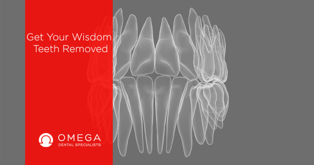 WisdomtoothRemovalbeforeafter Omega Dental Houston TX