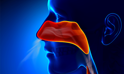 sinusitis after root canal