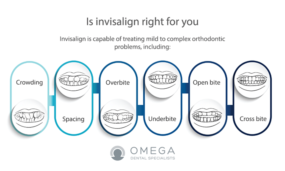 Invisalign Express & Teen  A Better Orthodontic Option?