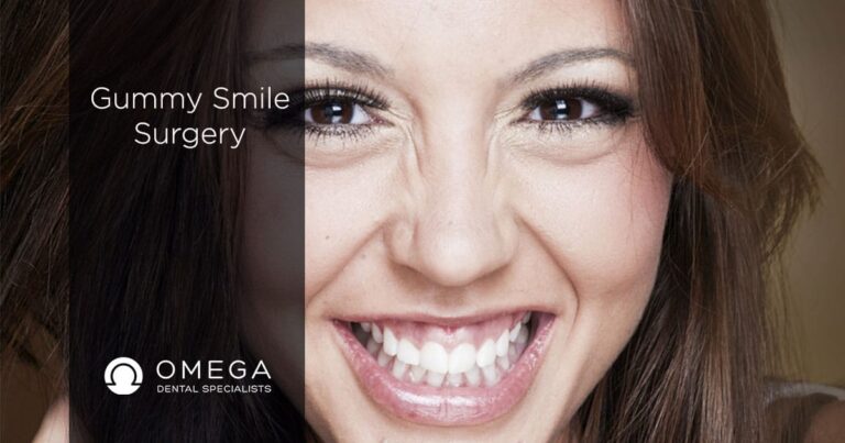 Gummy Smile Surgery Cost