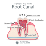 Infographics why root canal omega dental houston
