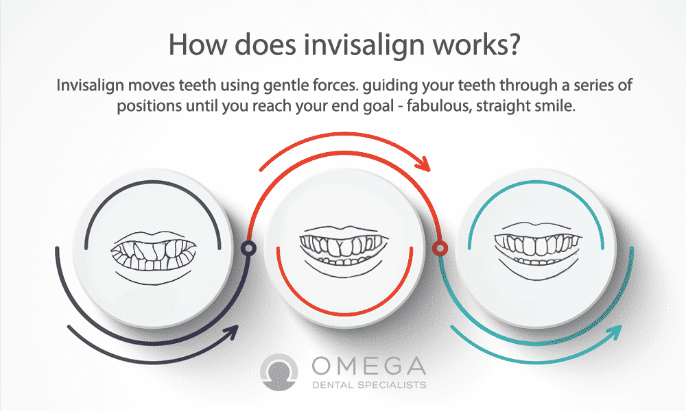 Infographics-Invisalign-Omega-Dental-Houston