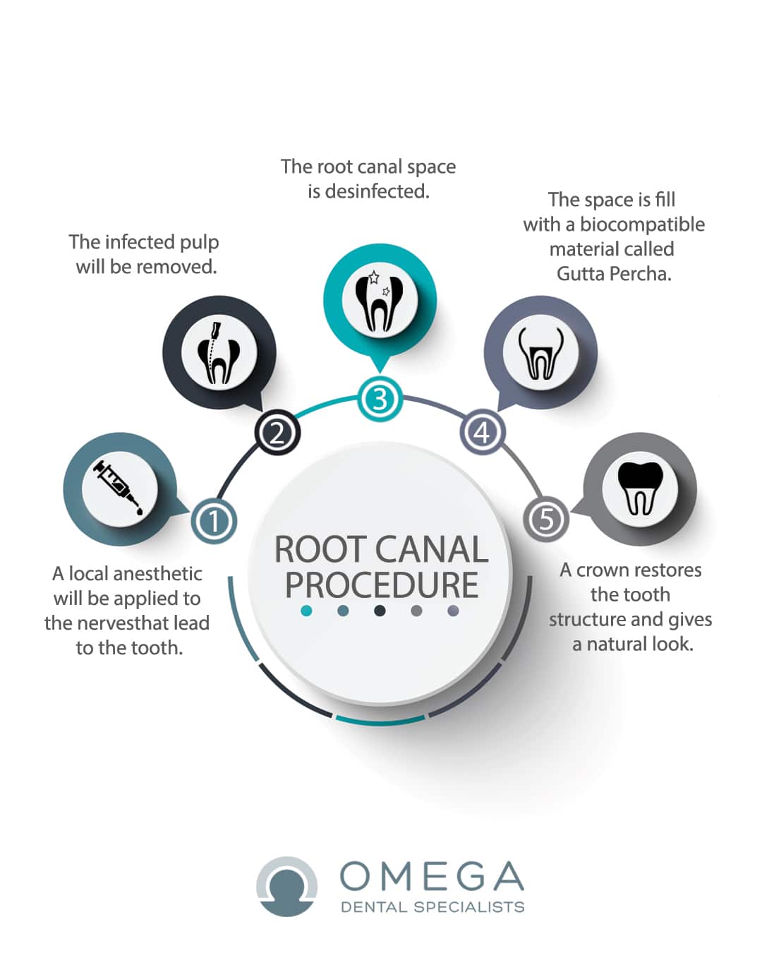 Infographic-root-canal-Omega-Dental-Houston