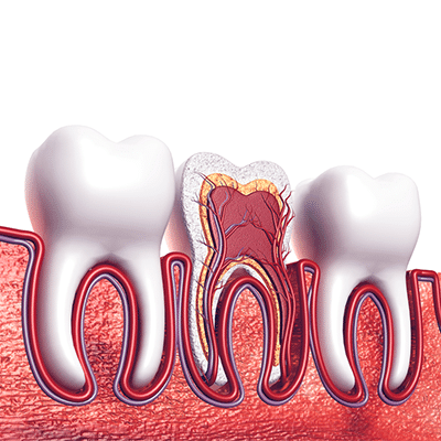 root-canal-treatment-for-kids-Houston